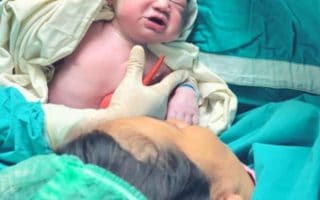 C-Section recovery tips