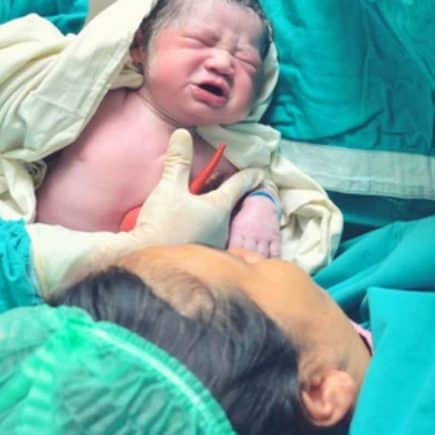 C-Section recovery tips