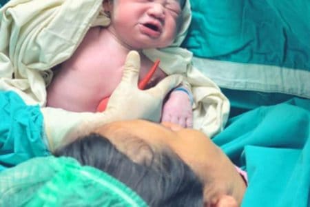 C-Section recovery tips